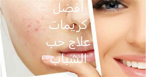 يزيل بسهولة ندبات حب الشباب والبقع الداكنة