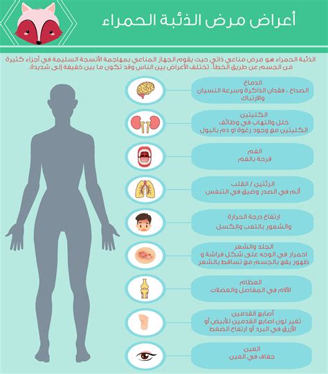 يمكن أن تكون التمارين ضارة لمريض الذئبة الحمراء