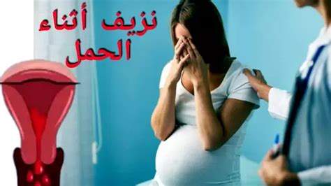 يمكن أن يحدث النزيف في بداية الحمل بسبب العوامل التالية: