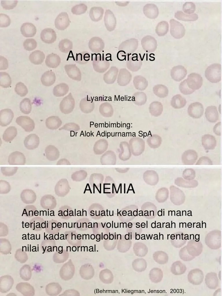Anemia Gravis PDF
