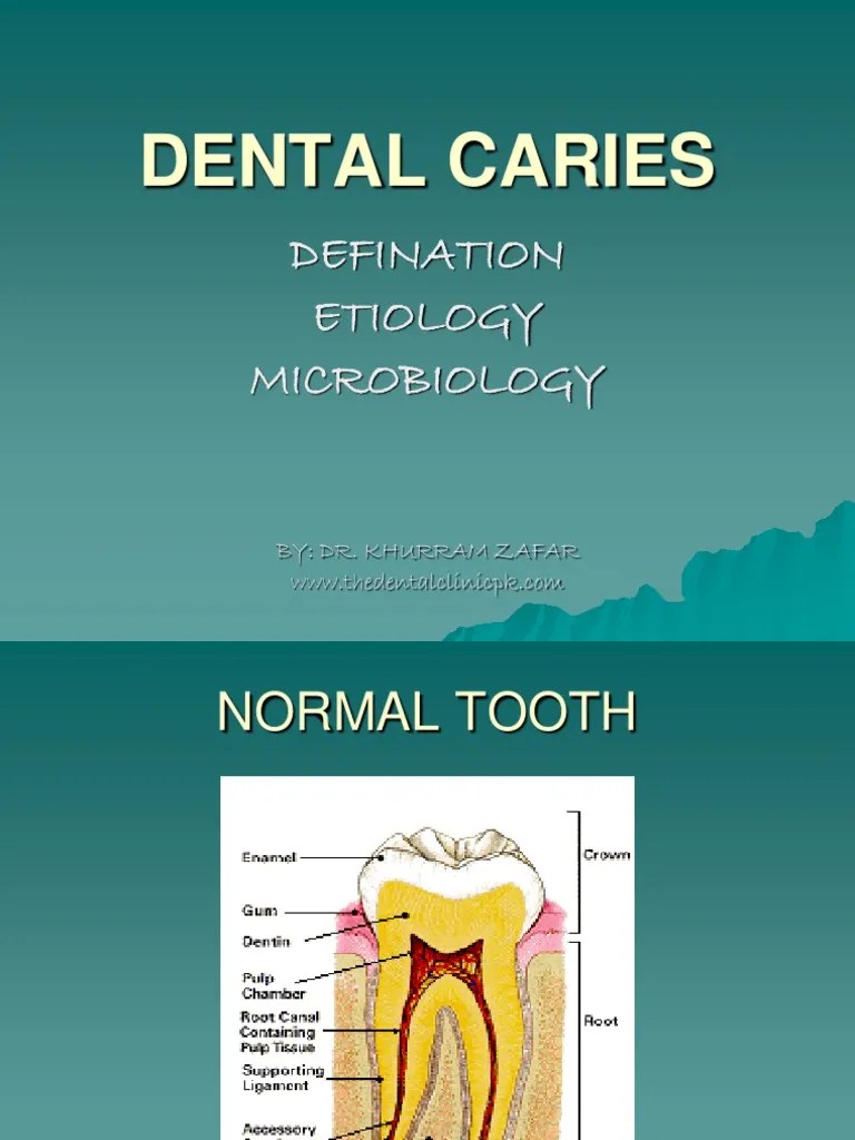 Understanding the Etiology, Microbiology, and Risk Factors of Dental