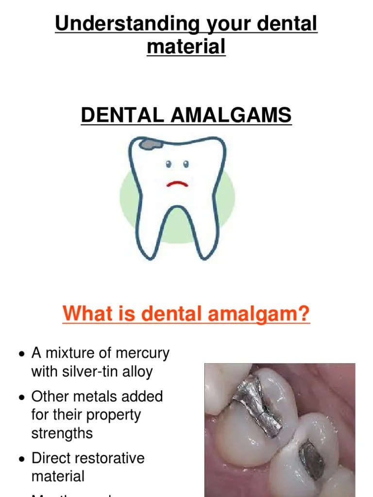 Amalgam Presentation PDF Mercury (Element) Alloy