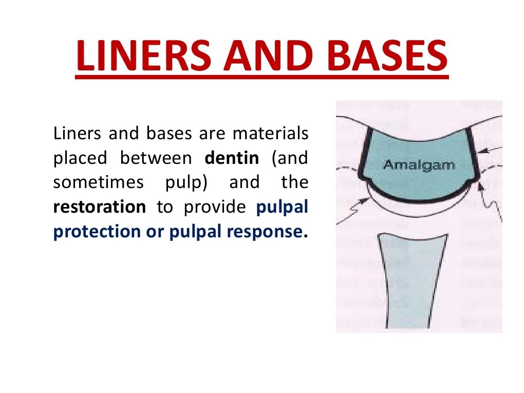 Liners and Bases Resin (10 views)