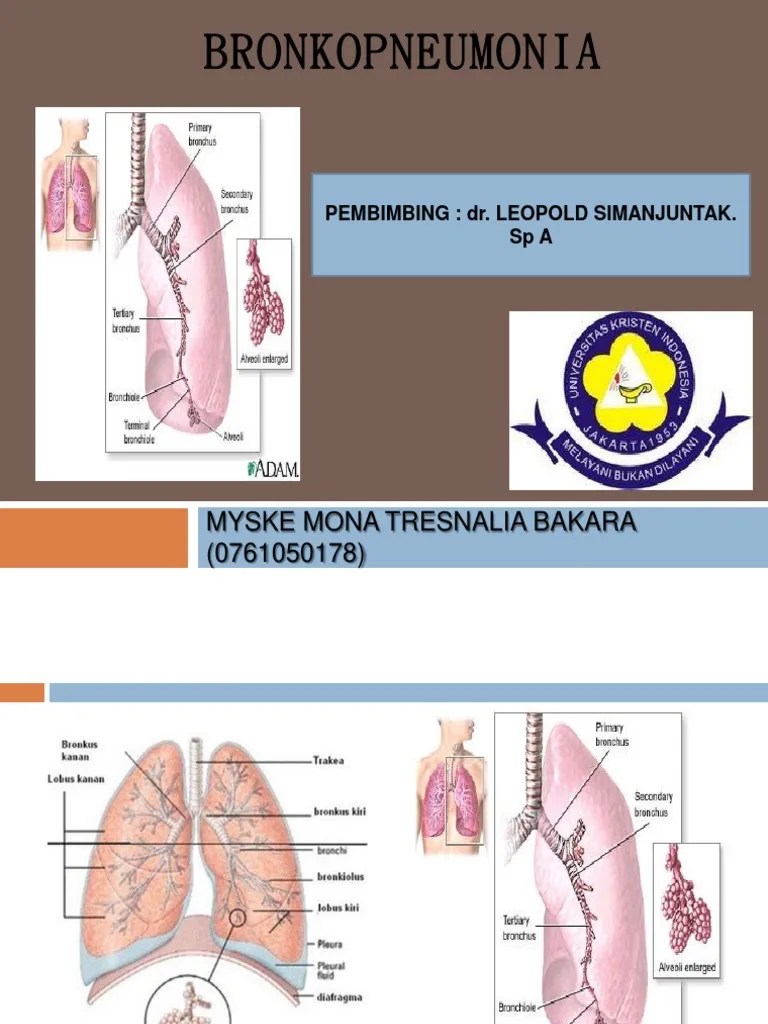 BRONKOPNEUMONIA IDAI PDF