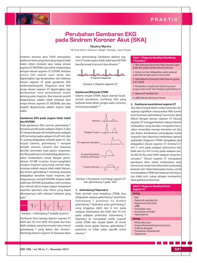 31_188Praktis Perubahan Gambaran EKG Pada Sindrom Koroner Akut