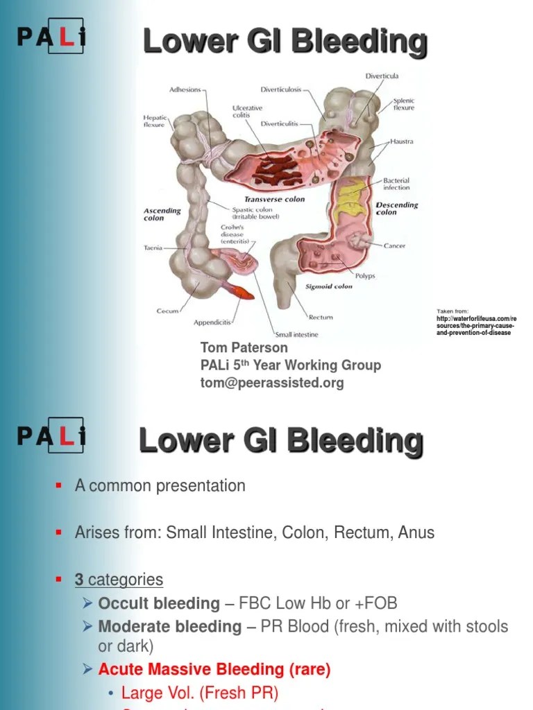 Lower GI Bleeding Crohn's Disease Colorectal Cancer
