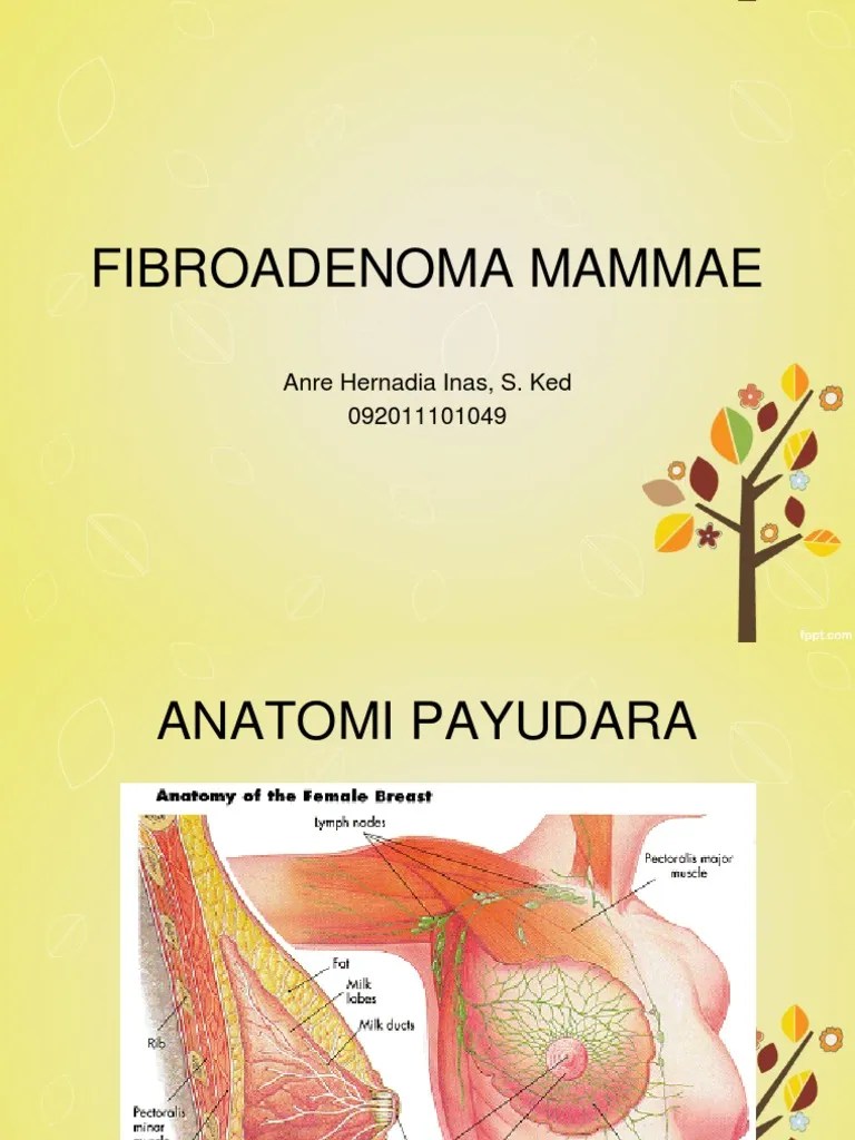 Fibroadenoma Mammae Ines