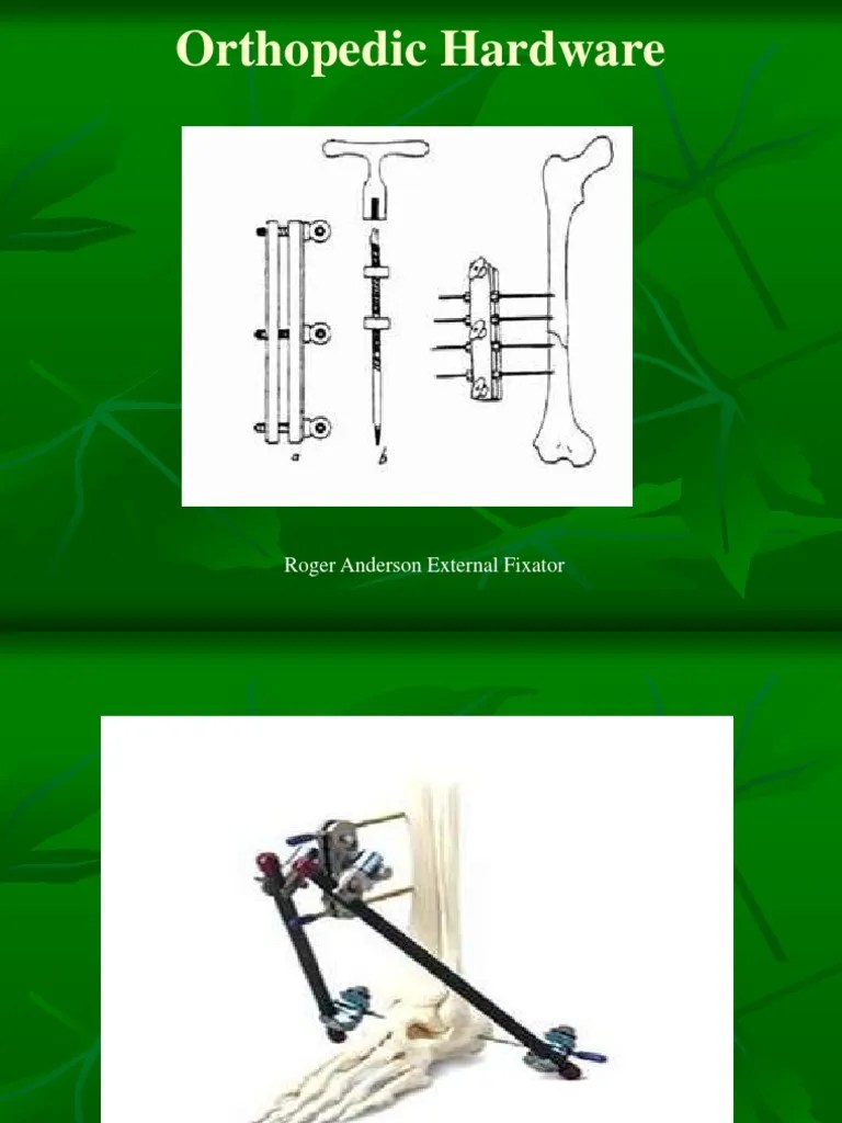 Orthopedic Hardware