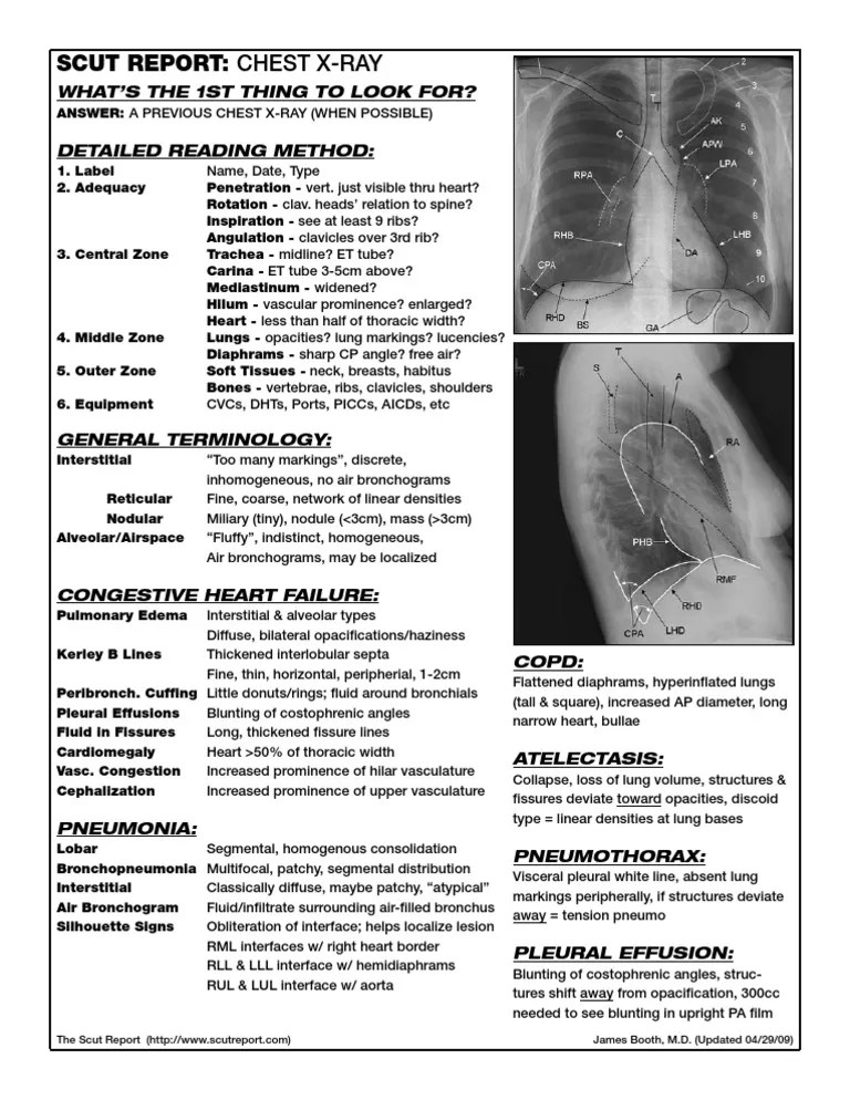 Scut Report Chest XRay Lung Thorax