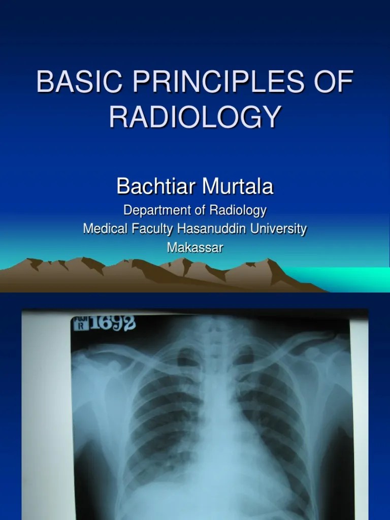 Basics Principles of Radiology PDF Radiology Medical Imaging