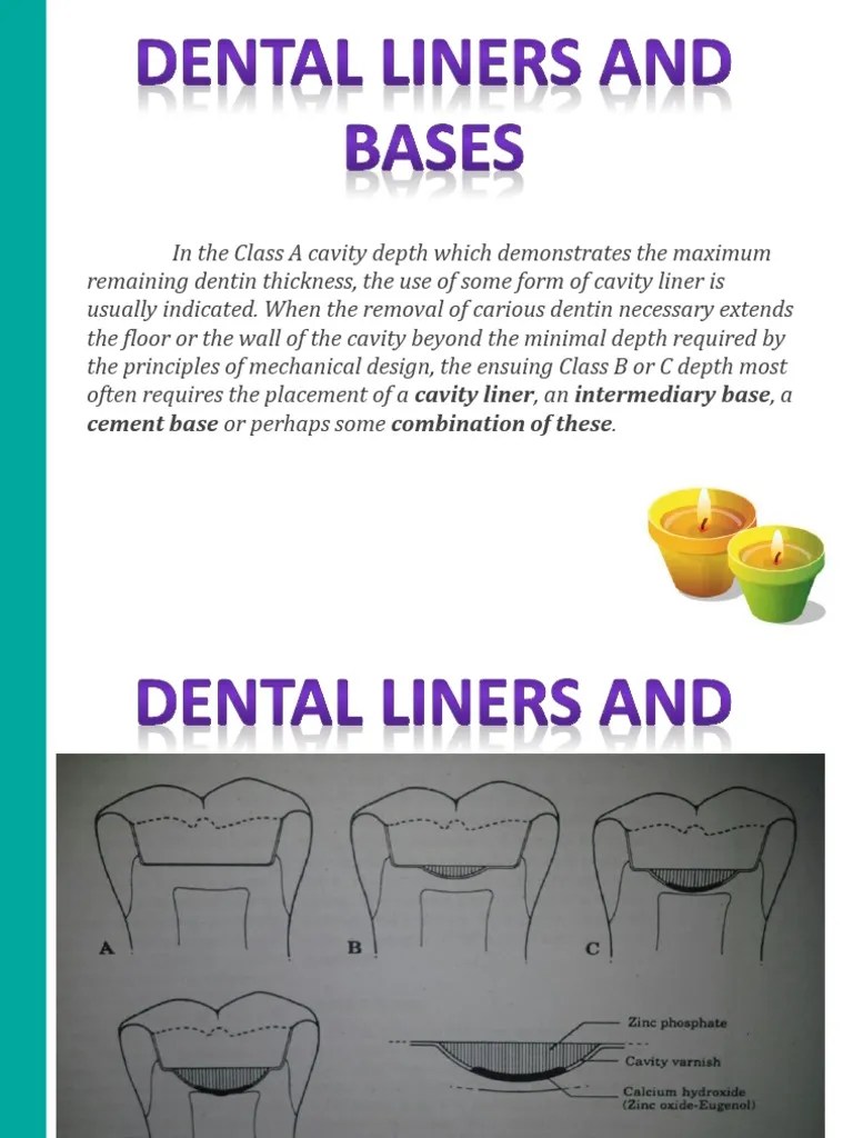 Dental Liners and Bases PDF