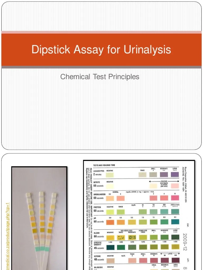 Dipstick Assay For Urinalysis PDF Ph Chemical Compounds