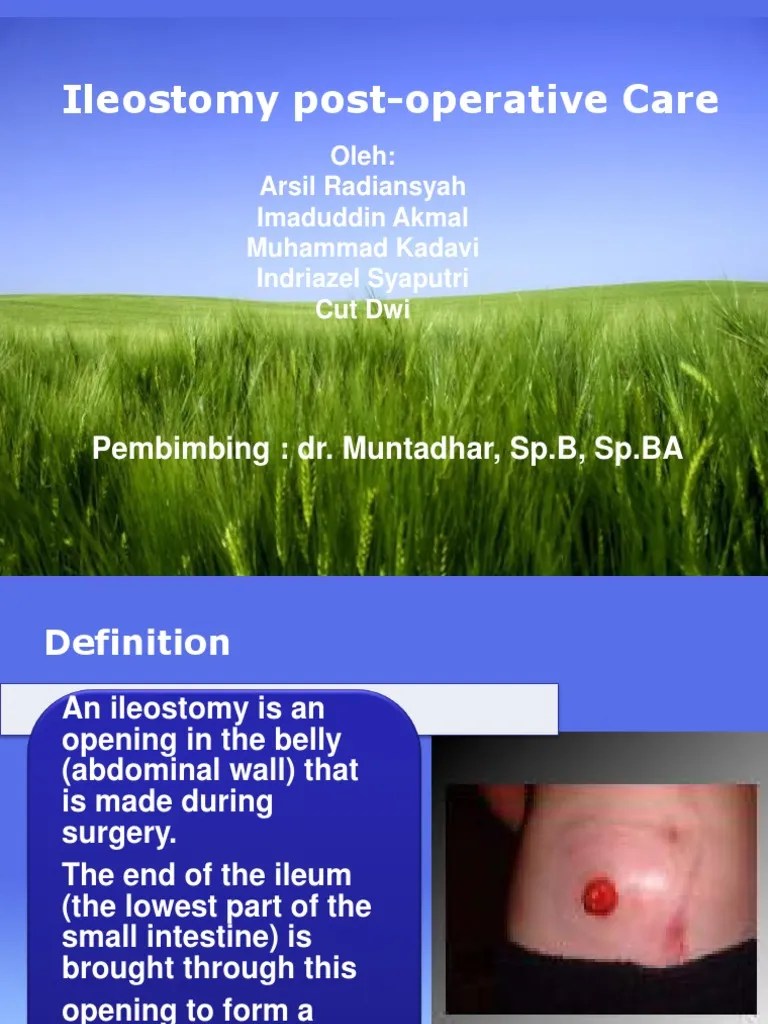 Ileostomy Care PDF Gastroenterology Medical Specialties