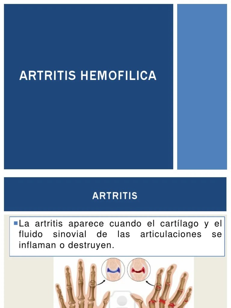 ARTRITIS HEMOFILICA PDF