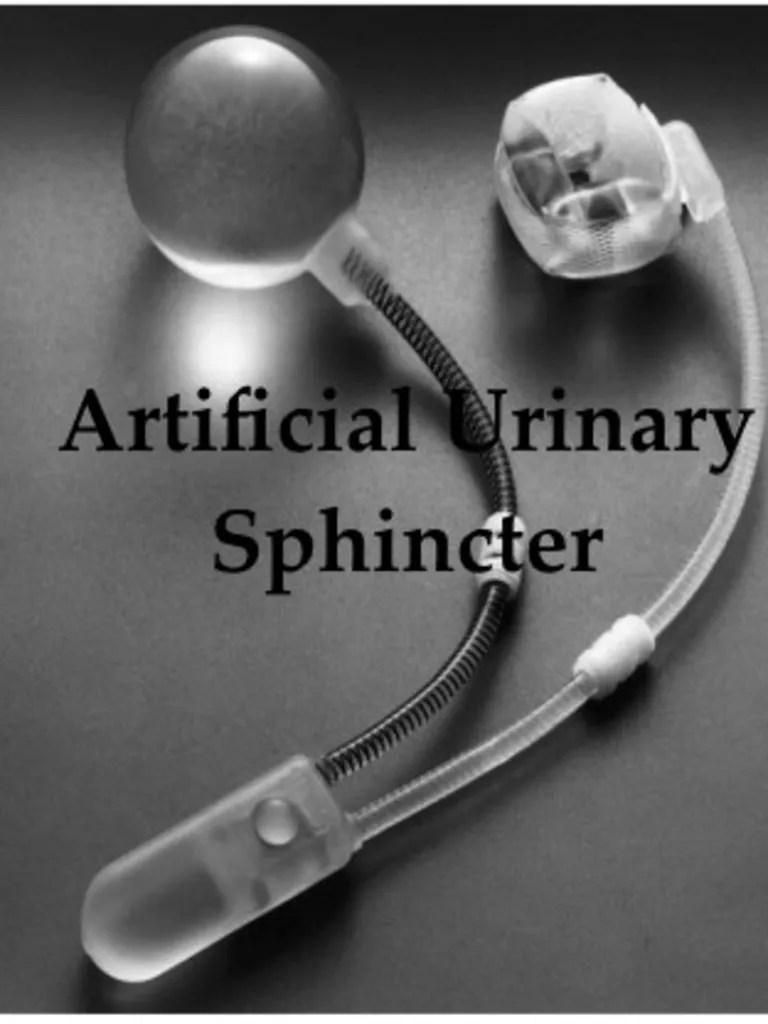 Artificial Urinary Sphincter Case Report PDF Urinary Incontinence Urinary Bladder