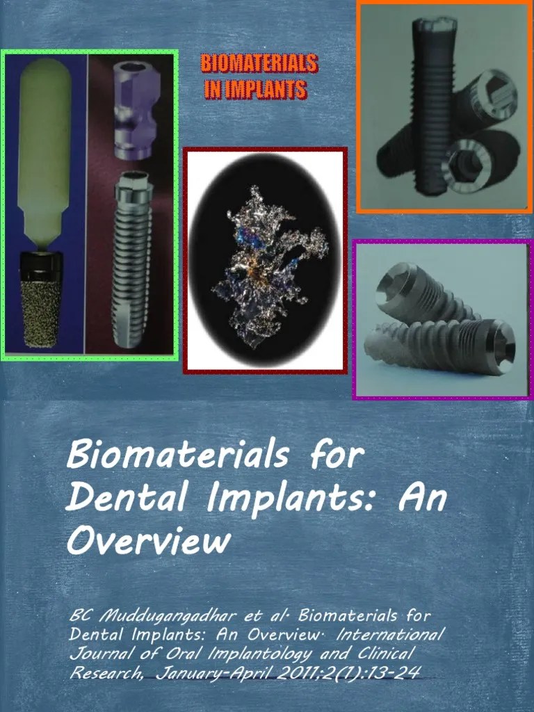 Biomaterials for Dental Implants Titanium Corrosion