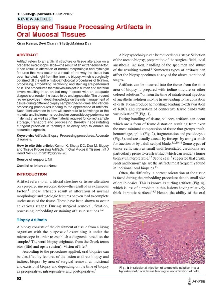 artifac Fixation (Histology) Biopsy