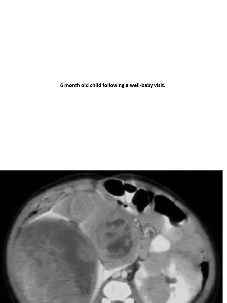 6 Month Old Child Following A WellBaby Visit PDF