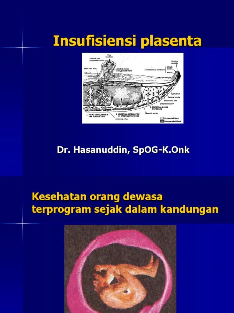 INSUFISIENSI PLASENTA