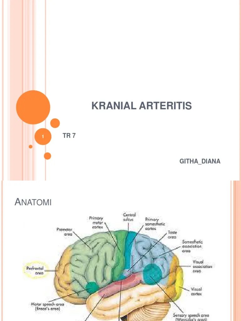 KRANIAL ARTERITIS