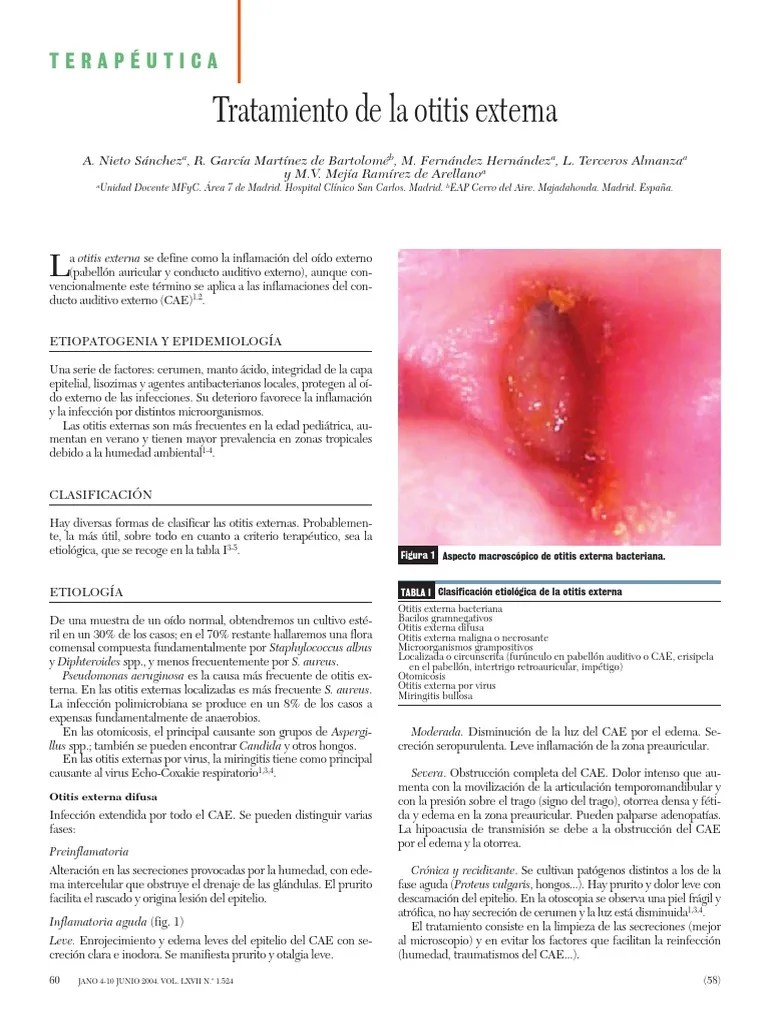 Otitis Pdf