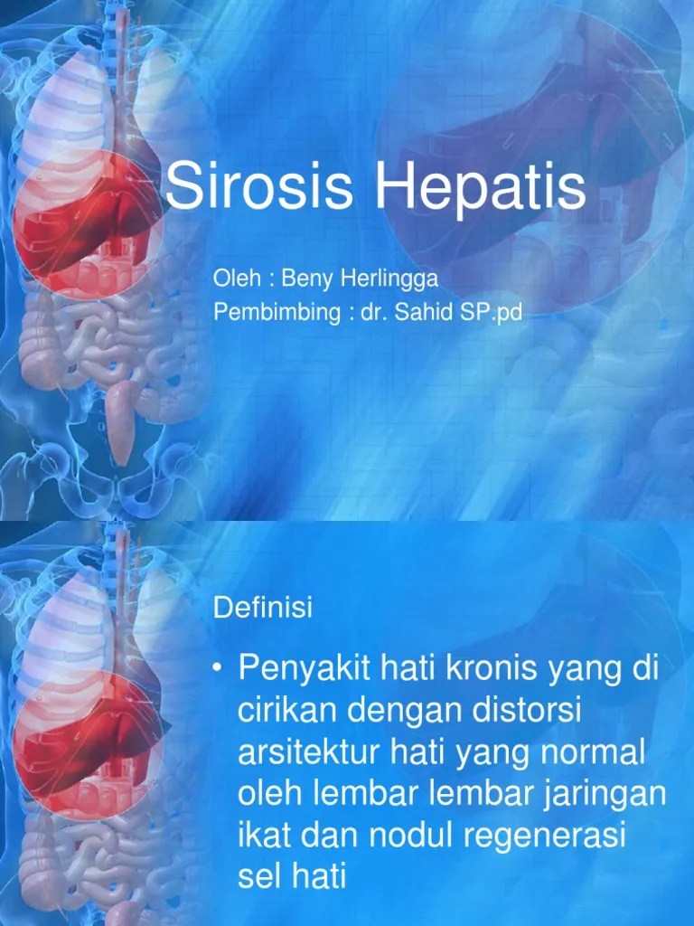 Sirosis Hepatis ppt