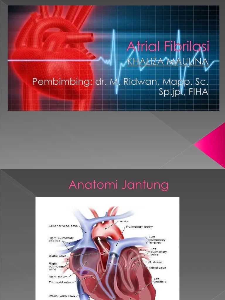 atrial fibrilasi