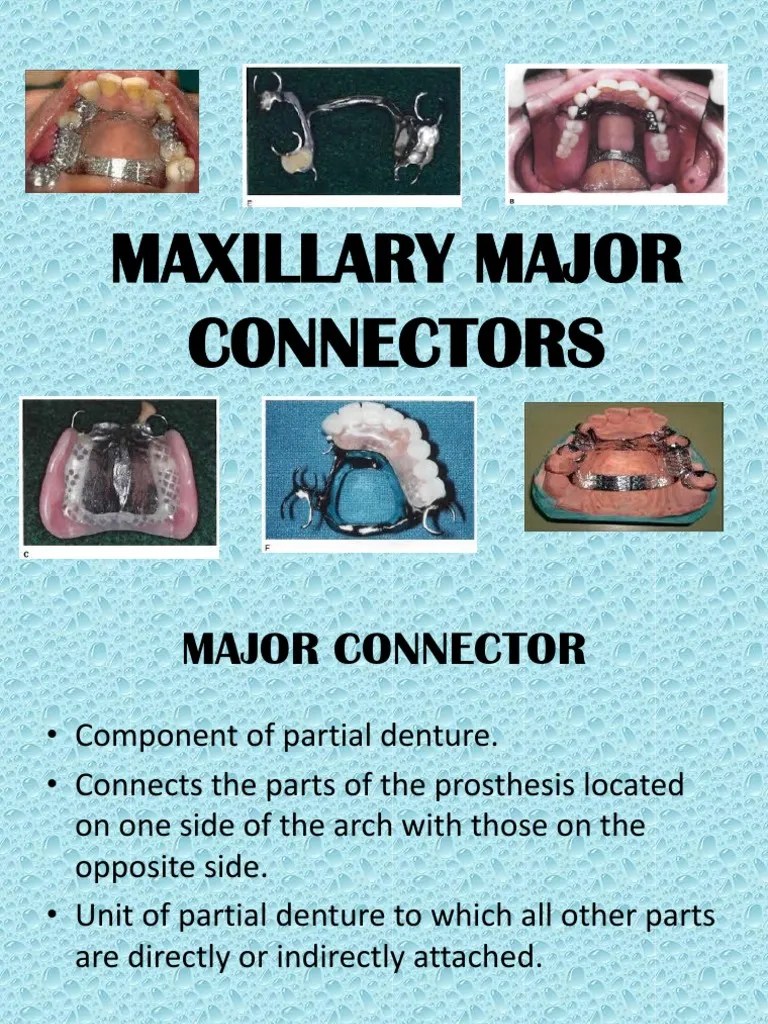 Maxillary Major Connectors Dentures Anatomical Terms Of Location
