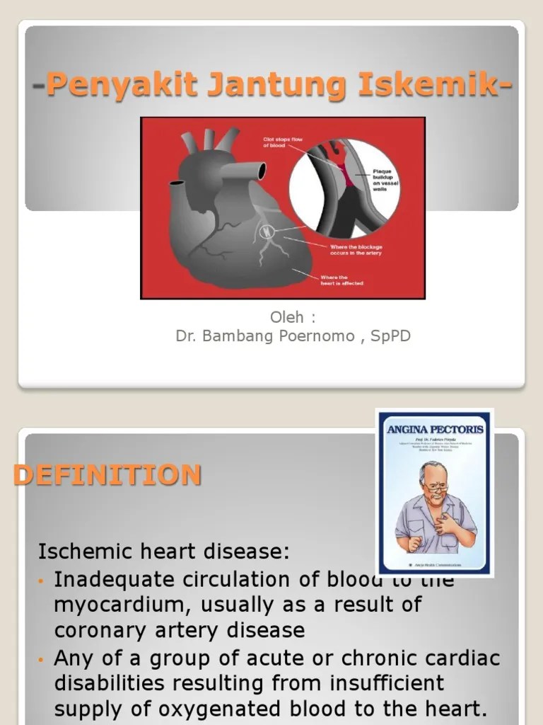 PENYAKIT JANTUNG ISKEMIK.ppt