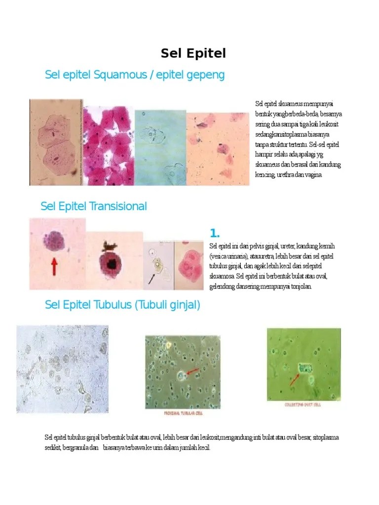 Atlas Sedimen Urin Edit - Sel Epitel