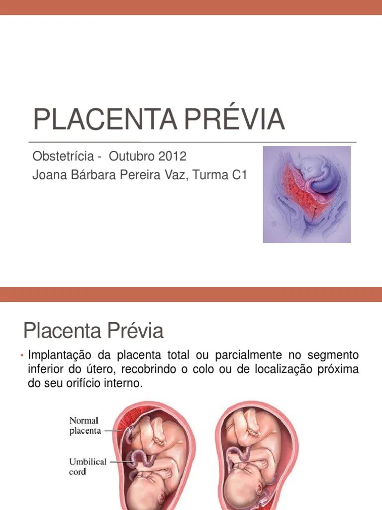 Placenta Prévia Gravidez Especialidades Médicas