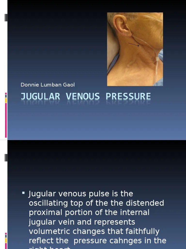 JVP examination for GP interna new.ppt Atrium (Heart) Vein