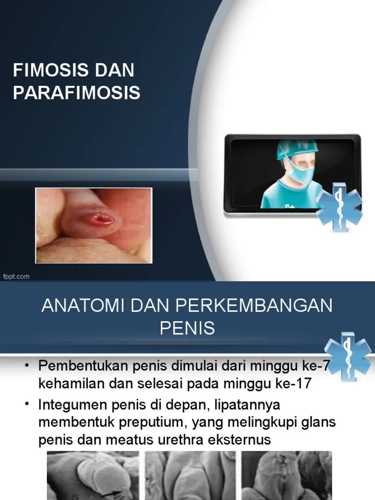 7. Fimosis Dan Parafimosis