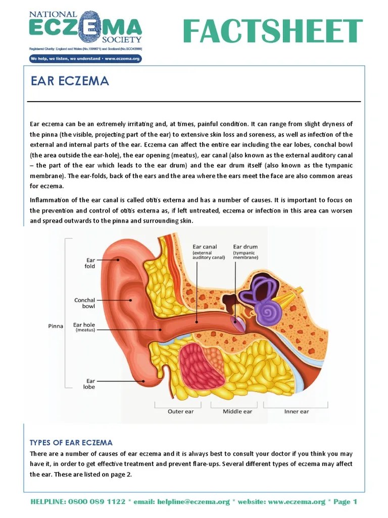 Ear Eczema 22 06 15 Dermatitis Ear
