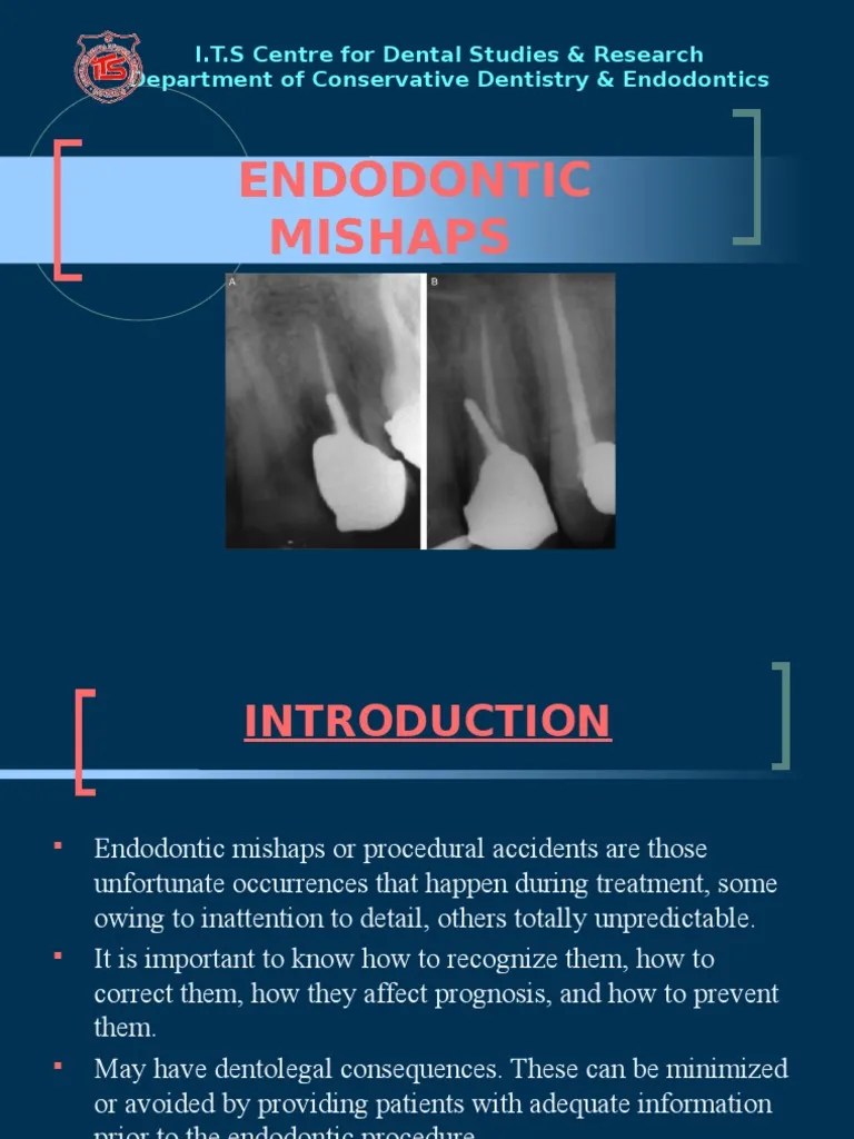 Endodontic Mishaps Medical Specialties Clinical Medicine