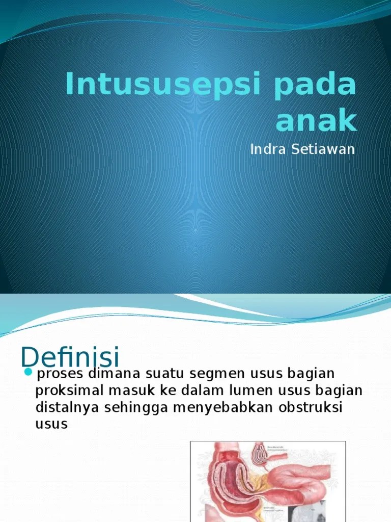 Intususepsi Pada Anak