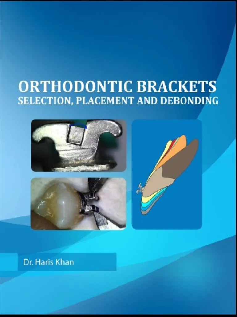 Orthodontic Bracket Titanium Stainless Steel