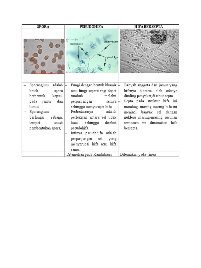Tugas Spora, DLL | PDF