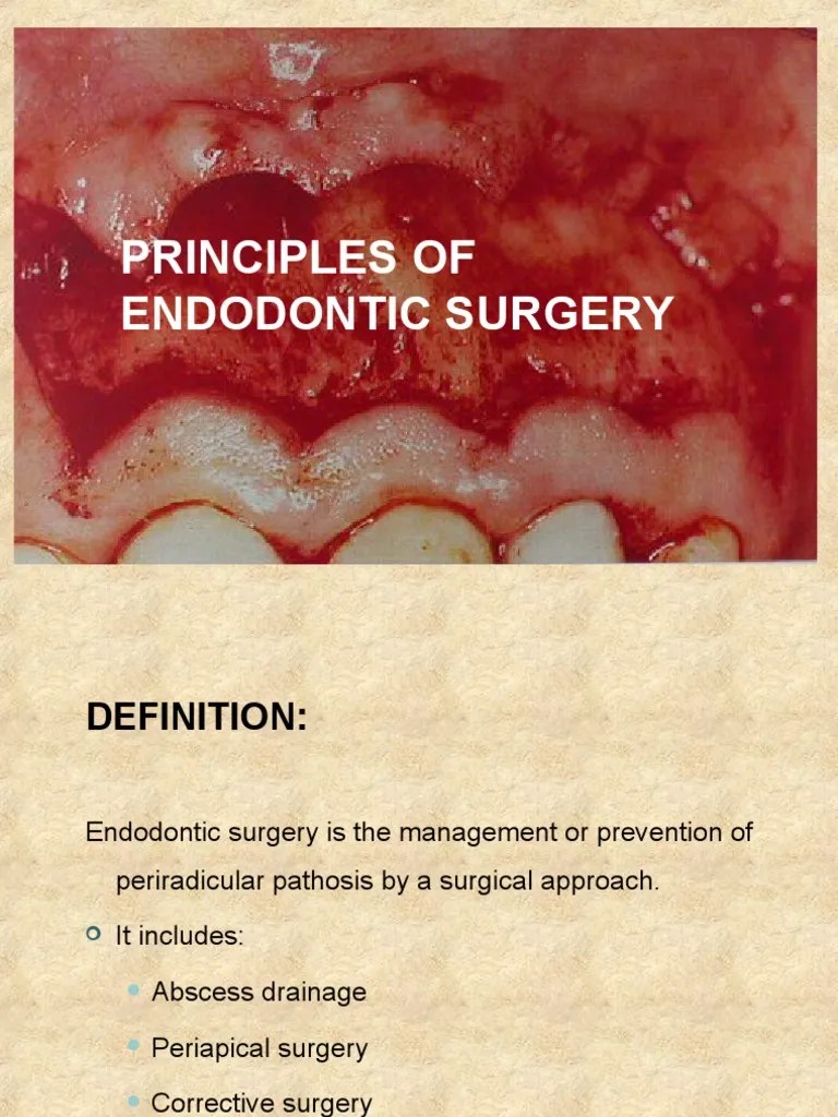 Principles of endodontic surgery Surgery Dentistry