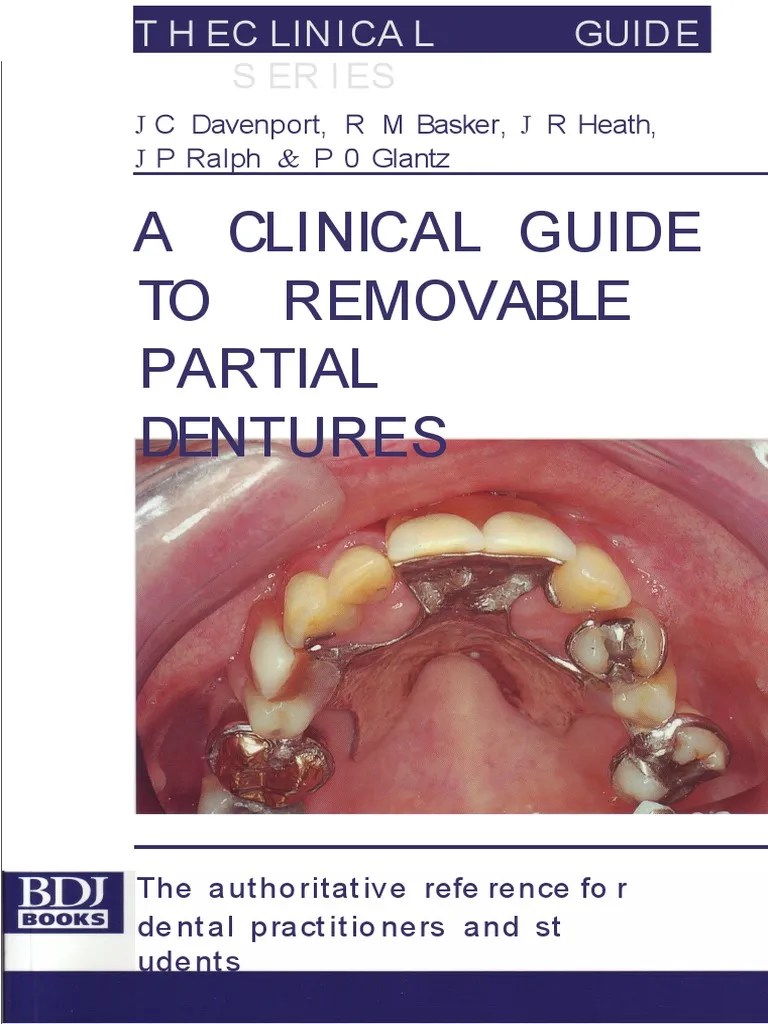 A Clinical Guide To Removable Partial Dentures PDF Periodontology