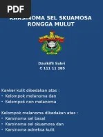 Penatalaksanaan Otitis Eksterna Maligna Jurnal Tht Kl