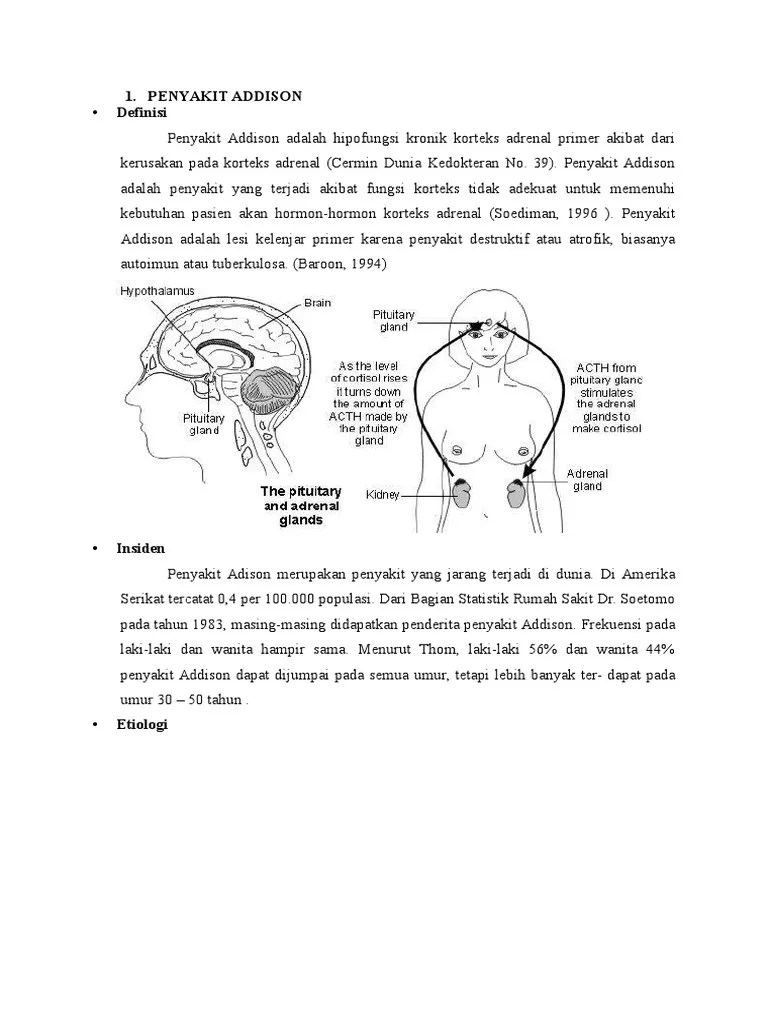 Addison Disease | PDF