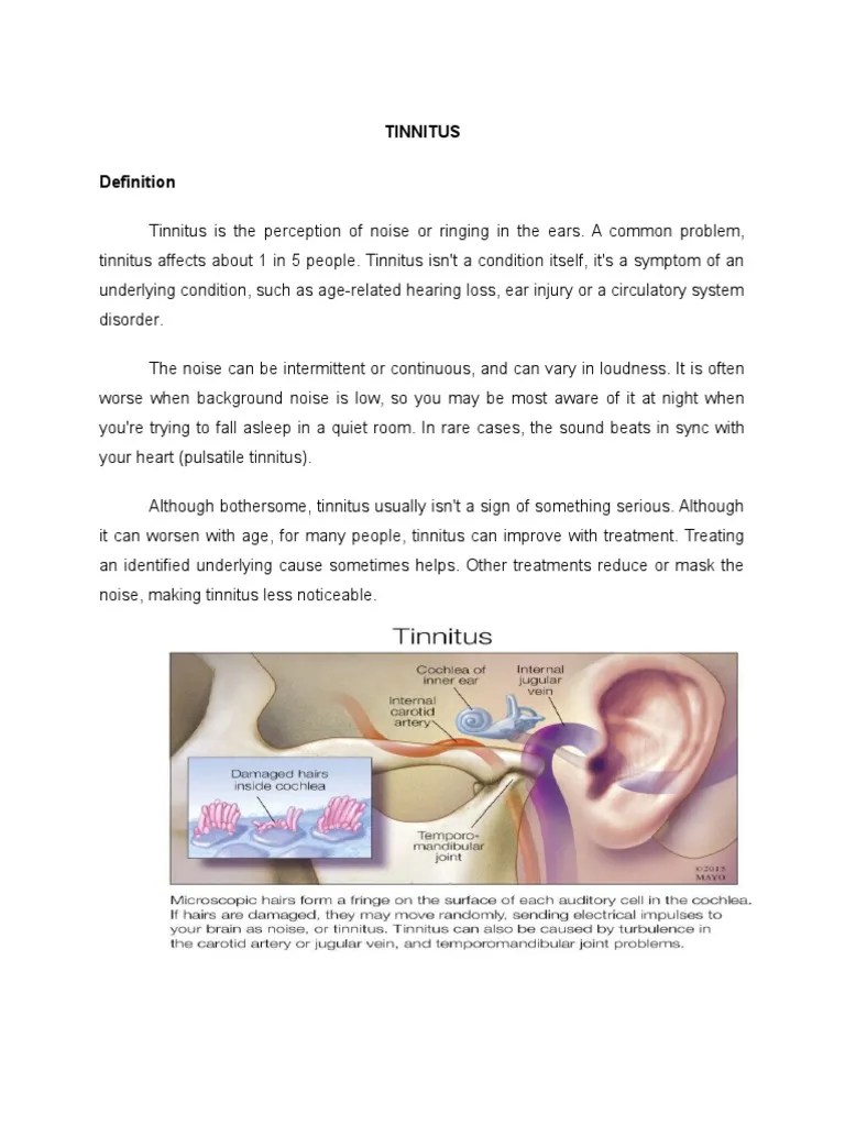 Tinnitus Tinnitus Ear