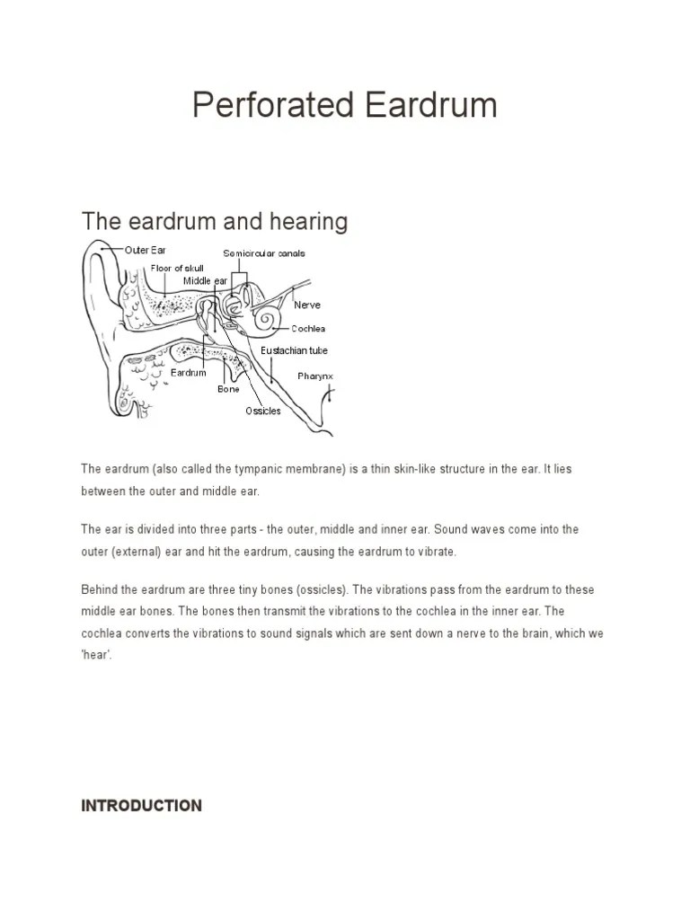 Perforated Eardrum Ear Hearing