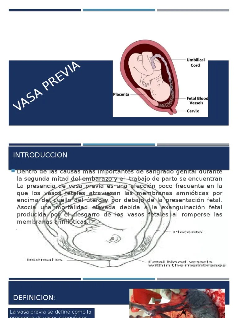 Vasa Previa Placenta Childbirth
