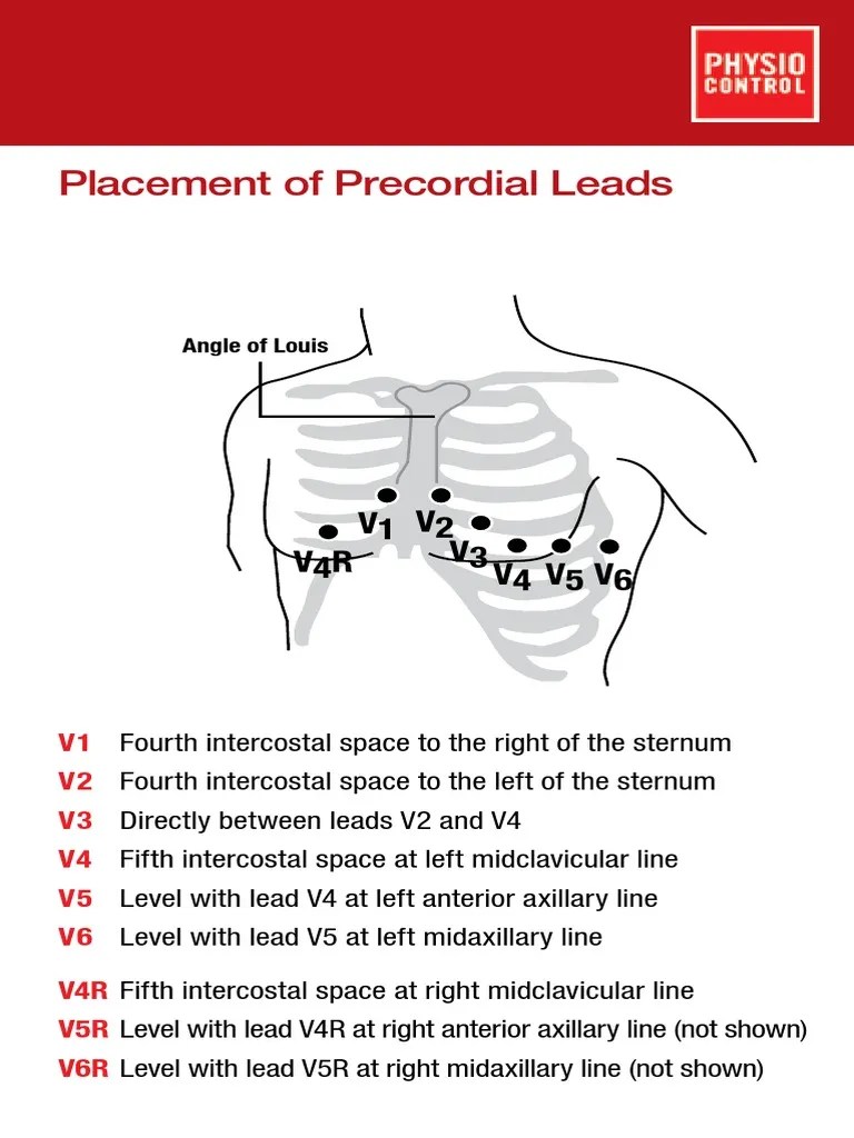 Precordial Leads Placement Card 3304235.A PDF PDF