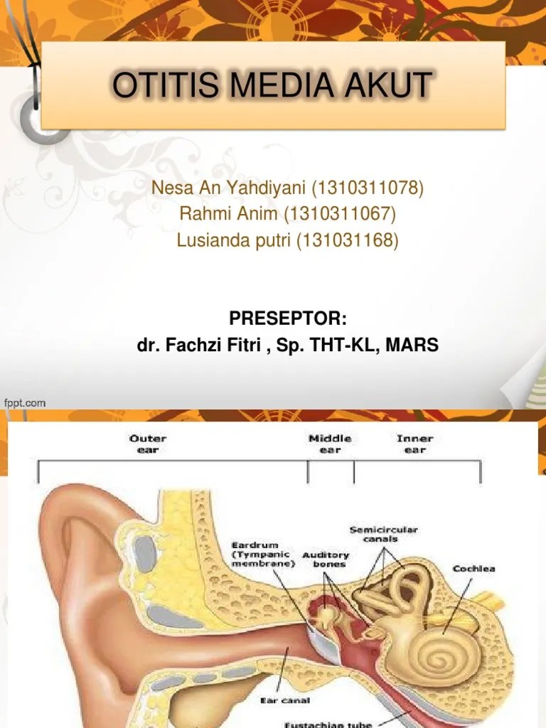 Mte Otitis Media Akut