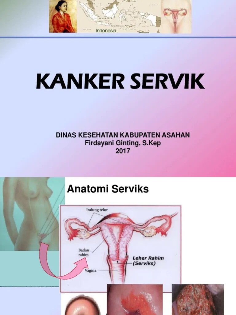 Materi Kanker Servik.ppt