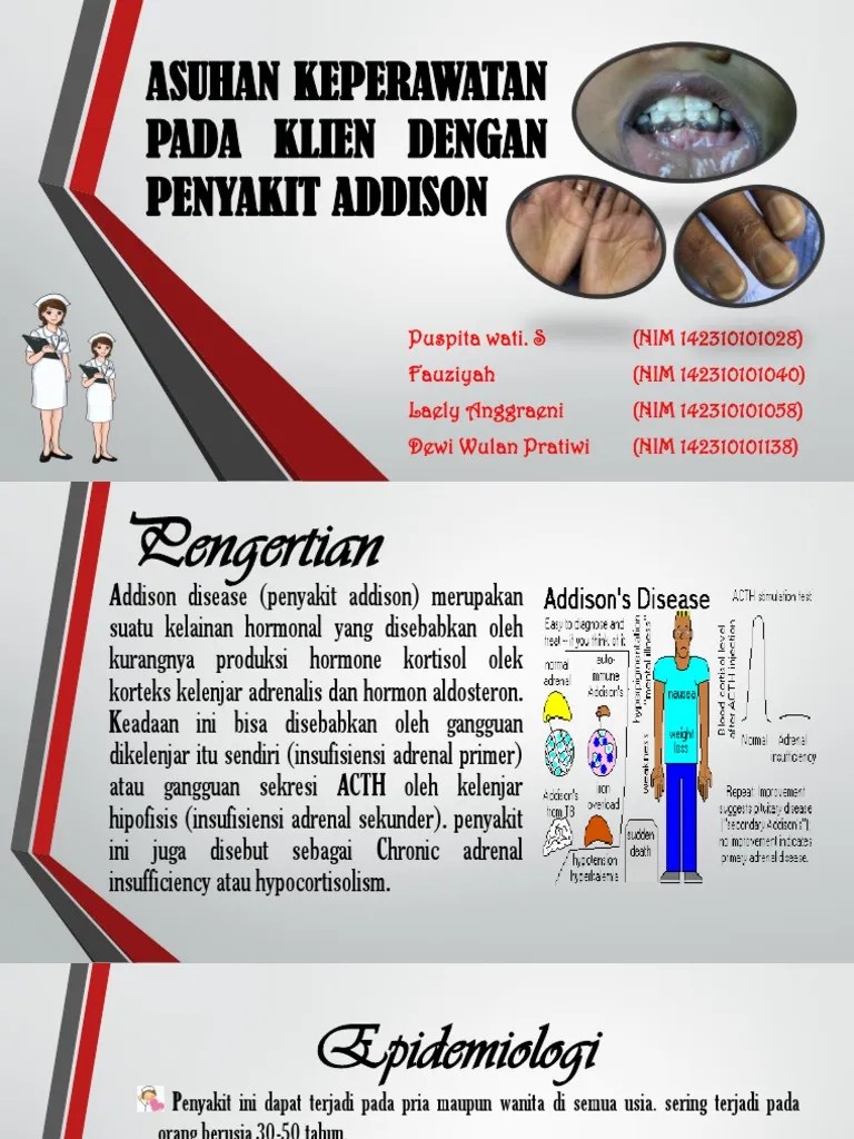 Addison Deseas Ppt