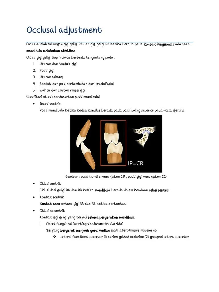 Occlusal Adjustment PDF